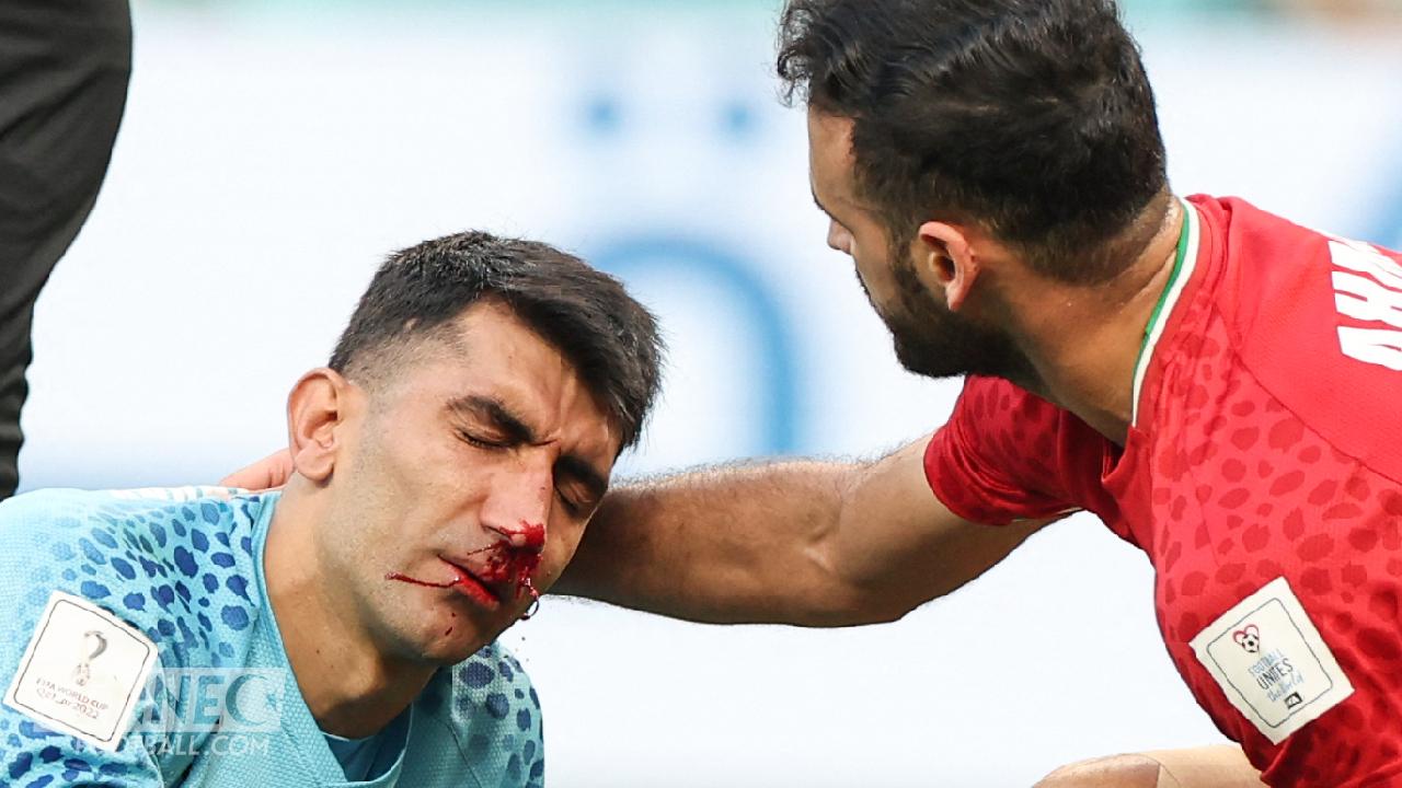 Angleterre Iran - Coupe du Monde 2022 : Le terrible choc du gardien iranien (Vidéo)