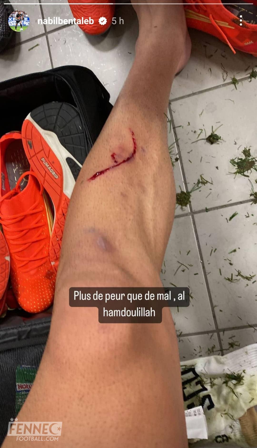 Bentaleb